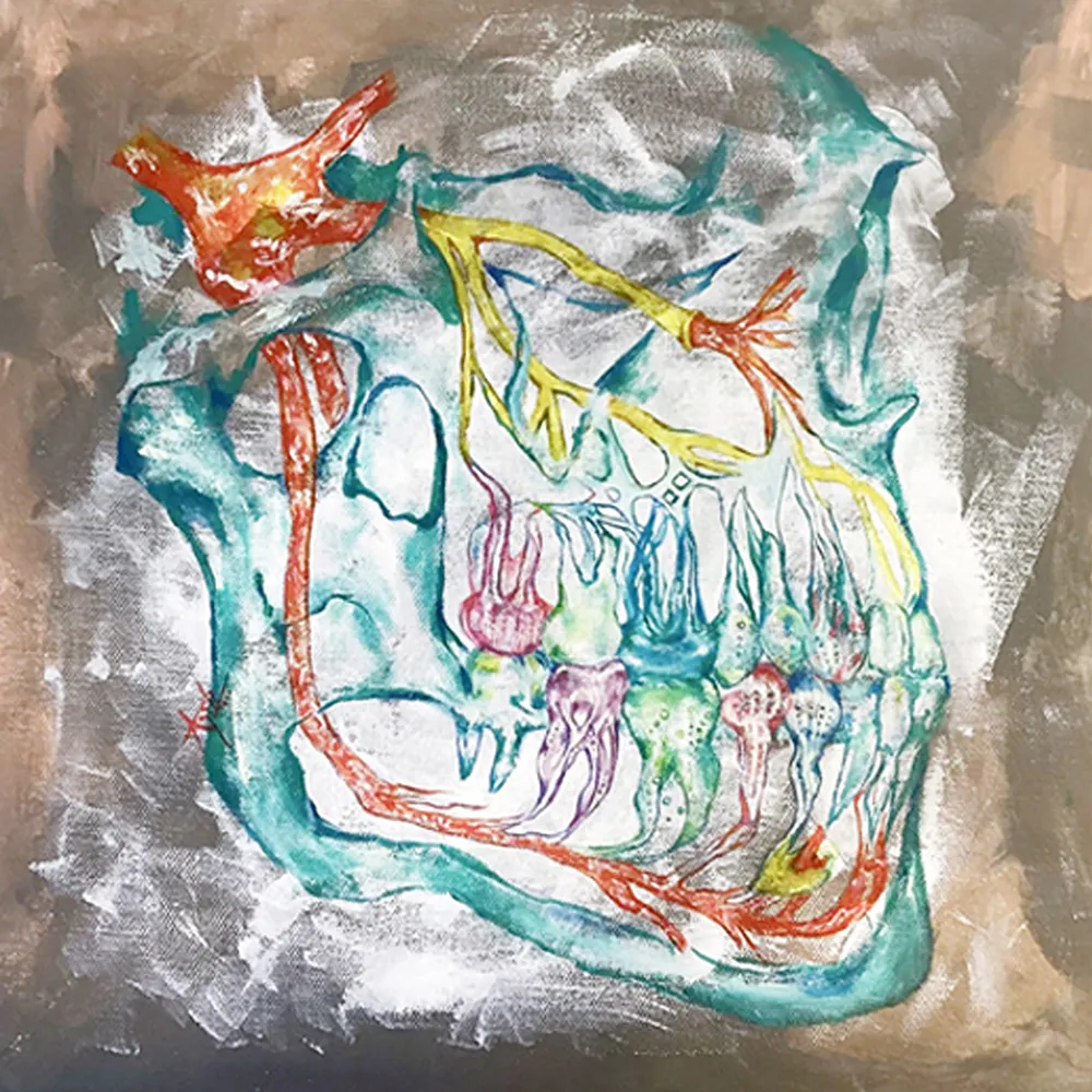Las Medusas